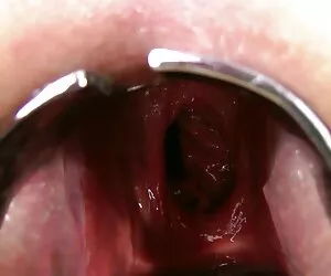 cómo deshacerse de sus senos después de un videos xxx caseros anal orgasmo